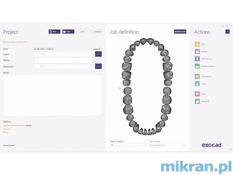 Exocad® DentalCAD Rijeka 3.1 versie CORE-ontwerpsoftware